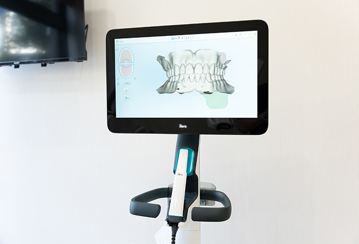 口腔内3Dスキャナー