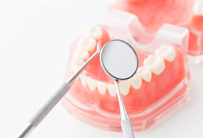 治療完了後のメンテナンス