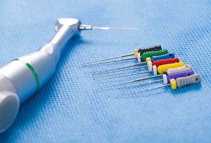 「ニッケルチタンファイル」によるやさしく効率的な治療