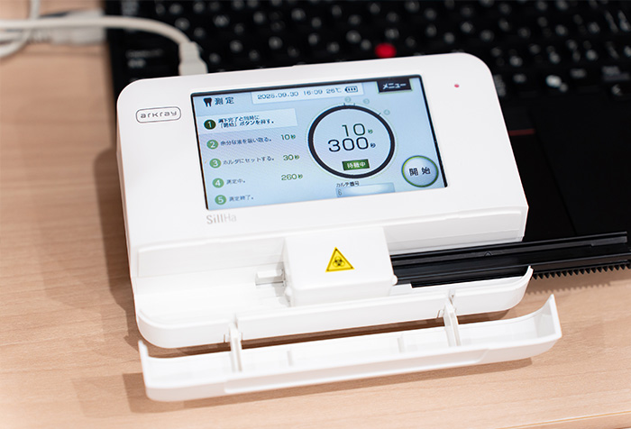 当院のむし歯治療の特徴